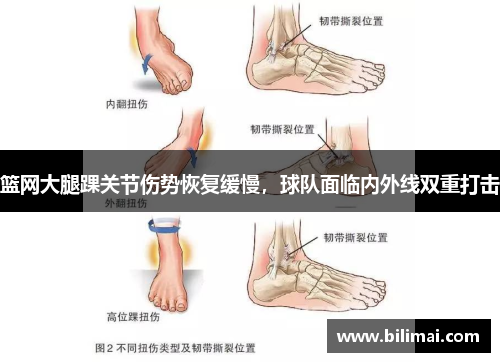 篮网大腿踝关节伤势恢复缓慢，球队面临内外线双重打击